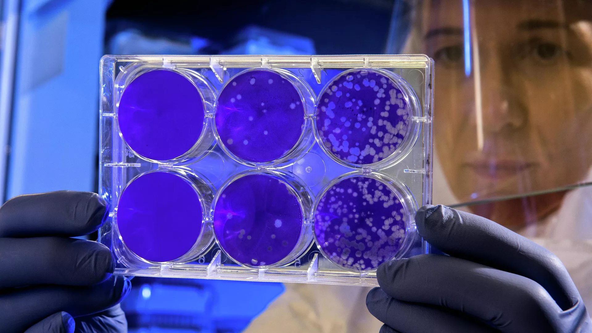 Bolivia: Insala, cuenta con laboratorios para diagnosticar casos de viruela del mono