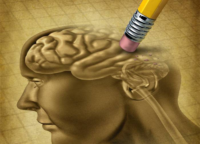 Nueva forma de tratar el Alzheimer