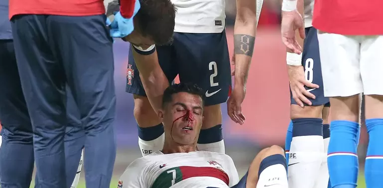 Cristiano Ronaldo recibe duro golpe jugando con Portugal