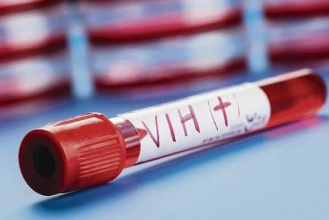 Cancelan estudio de la vacuna contra el VIH