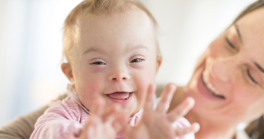 Europa registra menos nacimientos de bebés con síndrome de Down ¿Cuál es la razón?