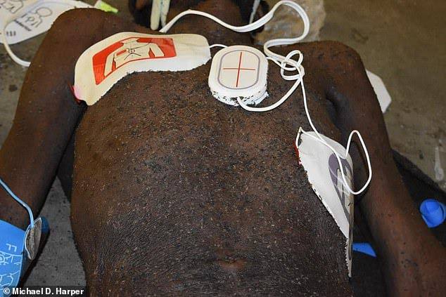 Lashawn Thompson, afroamericano que muere al ser deborado por chinches en una celda de EEUU