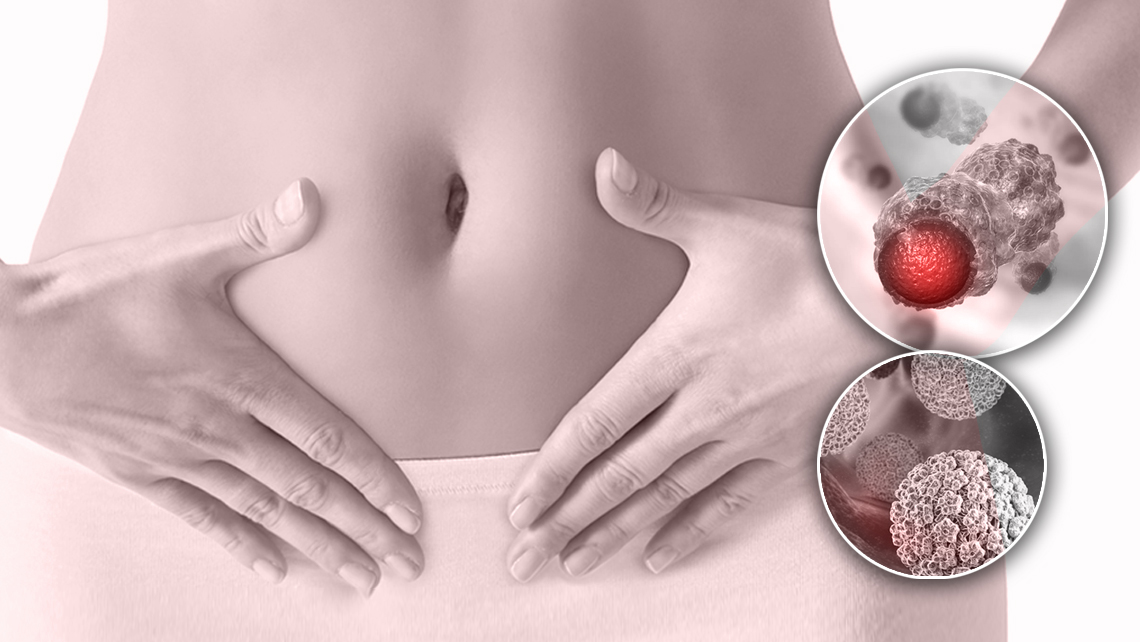 Niñas nicaragüenses serán vacunadas contra el virus de papiloma humano