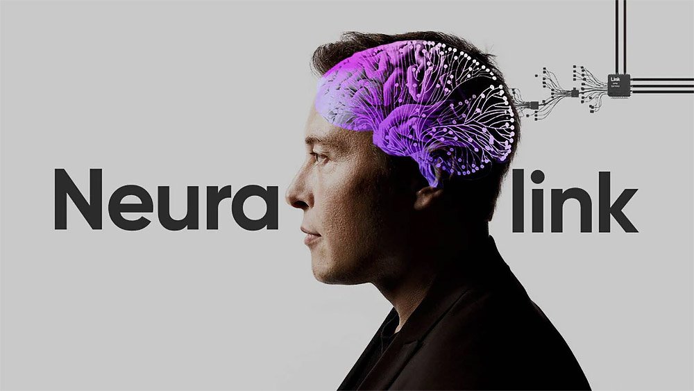 Instalan primer implante cerebral en un ser humano
