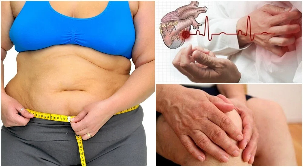 Alerta de Salud: Descifrando los peligros del Sobrepeso y la Obesidad