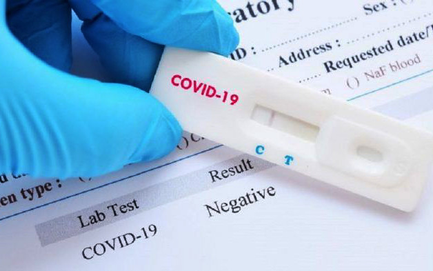 Nicaragua reporta menos contagio por Covid-19