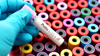 30 años de erradicación del poliovirus en las Américas