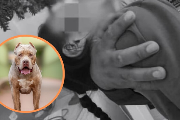 Niña resulta gravemente herida tras ataque de perro pitbull en Masaya