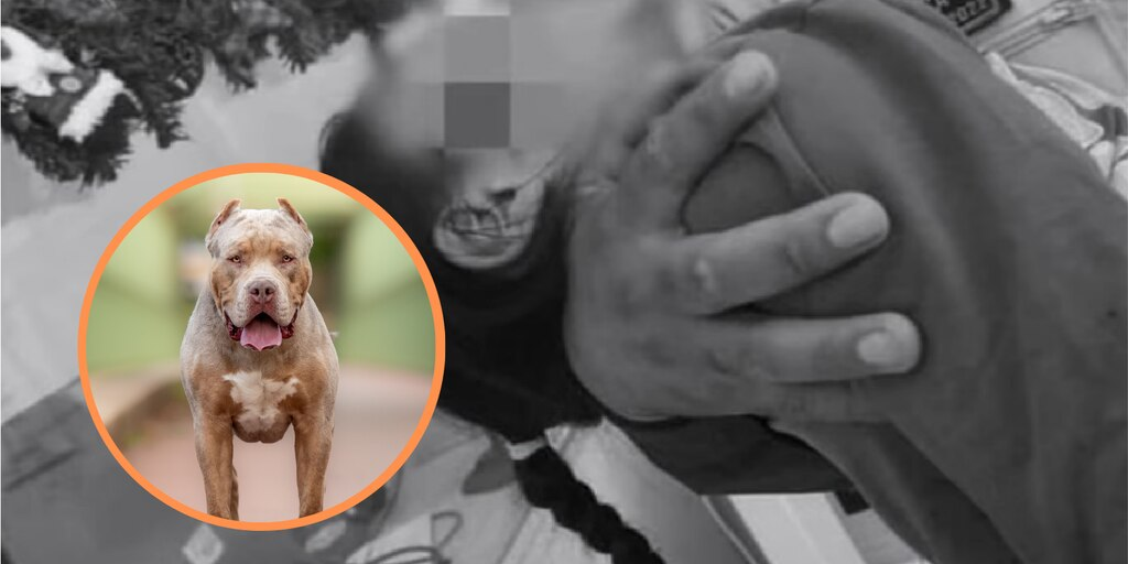 Niña resulta gravemente herida tras ataque de perro pitbull en Masaya