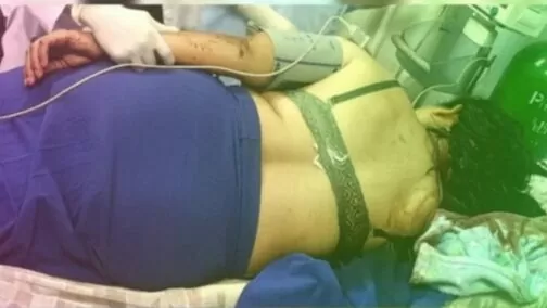 Mujer lucha por su vida tras recibir machetazos de su expareja en El Rama
