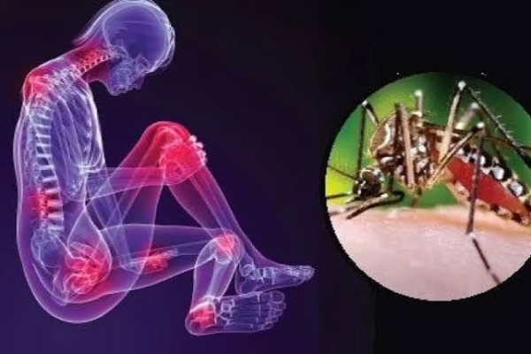 Chikungunya ¿quién es inmune y cómo evitar más contagios?