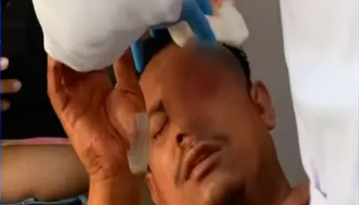 Mujer saca un ojo a hombre de un botellazo en Managua